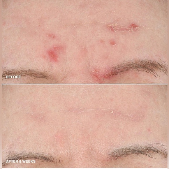 Bobbi Brown Vitamin Enriched Smoothing Serum Brand New in Box Authentic - Picture 4 of 13